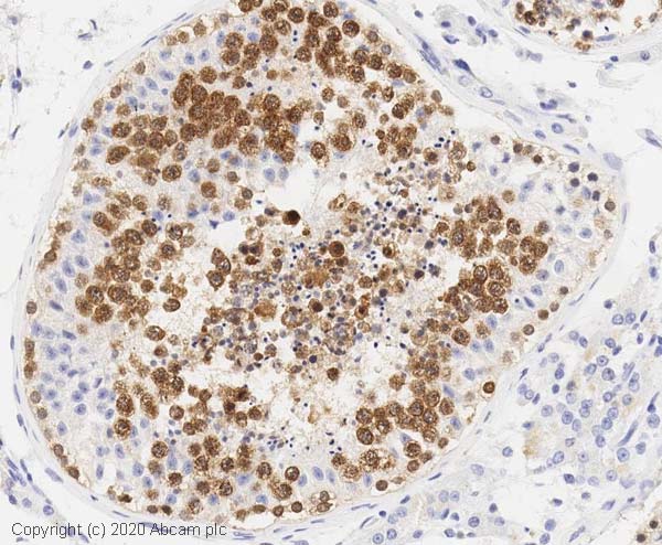 Immunohistochemistry (Formalin/PFA-fixed paraffin-embedded sections) - Anti-DDX4 / MVH antibody [mAbcam27591] (AB27591)