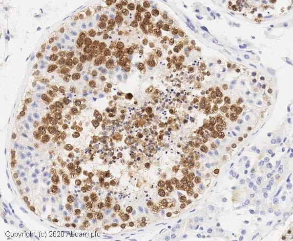 Anti-DDX4 / MVH antibody [mAbcam27591] (ab27591) | Abcam