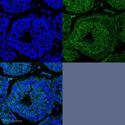 Immunohistochemistry (Formalin/PFA-fixed paraffin-embedded sections) - Anti-DDX4 / MVH antibody [mAbcam27591] (AB27591)