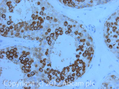 Immunohistochemistry (Formalin/PFA-fixed paraffin-embedded sections) - Anti-DDX4 / MVH antibody [mAbcam27591] - BSA and Azide free (AB180462)