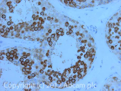 Immunohistochemistry (Formalin/PFA-fixed paraffin-embedded sections) - Anti-DDX4 / MVH antibody [mAbcam27591] - BSA and Azide free (AB180462)