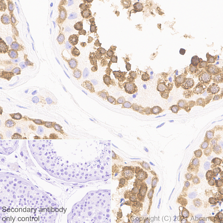 Immunohistochemistry (Formalin/PFA-fixed paraffin-embedded sections) - Anti-DDX4 / MVH antibody [RM1022] (AB284611)