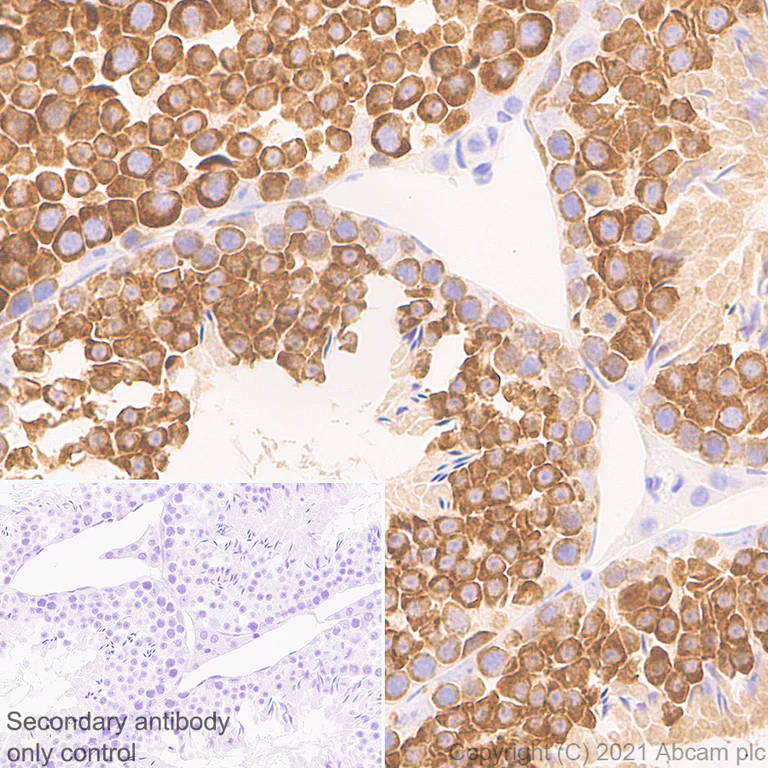 Immunohistochemistry (Formalin/PFA-fixed paraffin-embedded sections) - Anti-DDX4 / MVH antibody [RM1022] - BSA and Azide free (AB284612)