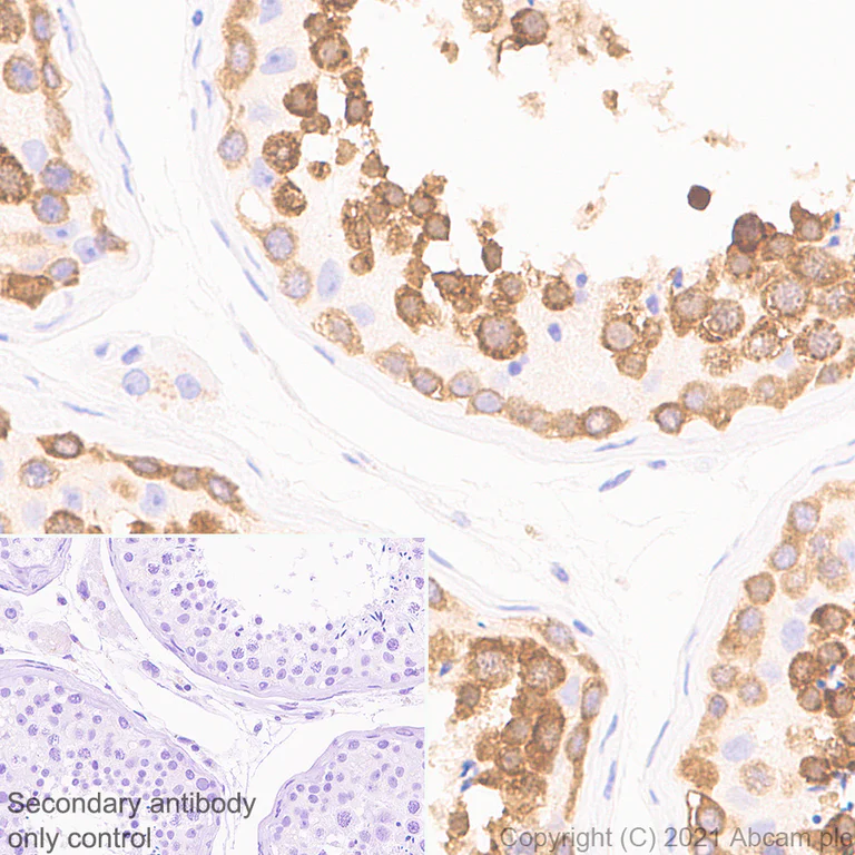 Immunohistochemistry (Formalin/PFA-fixed paraffin-embedded sections) - Anti-DDX4 / MVH antibody [RM1022] - BSA and Azide free (AB284612)