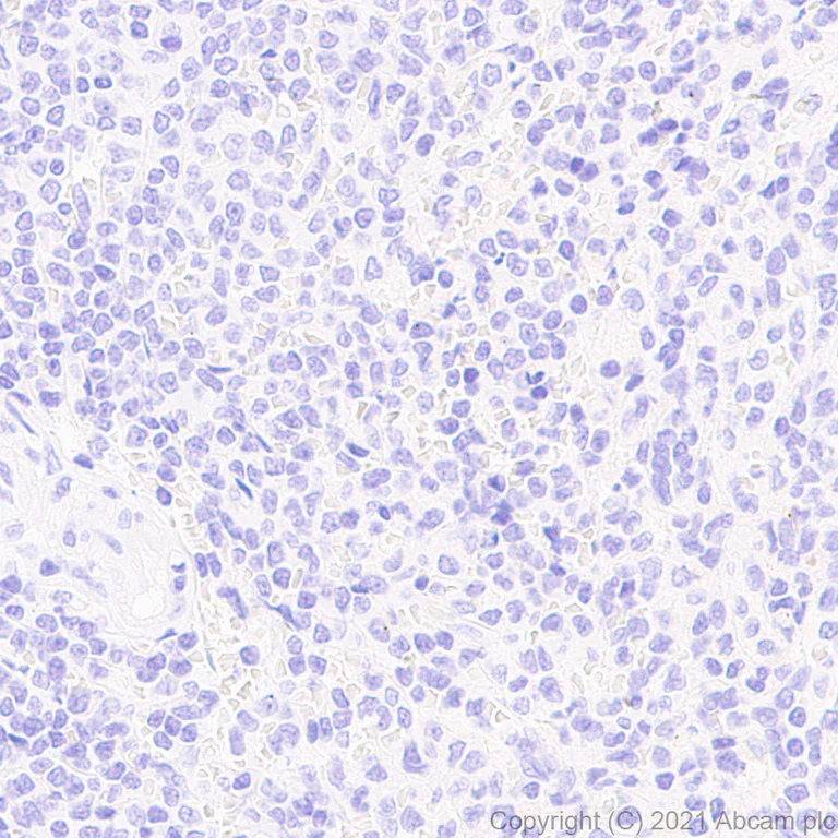 Immunohistochemistry (Formalin/PFA-fixed paraffin-embedded sections) - Anti-DDX4 / MVH antibody [RM1022] - BSA and Azide free (AB284612)