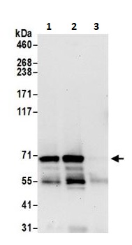 Immunoprecipitation - Anti-DDX41 antibody (AB264173)