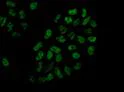 Immunocytochemistry/ Immunofluorescence - Anti-DDX41 antibody [EPR14298] - BSA and Azide free (AB250572)