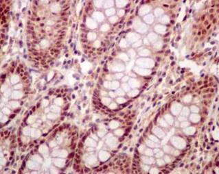 Immunohistochemistry (Formalin/PFA-fixed paraffin-embedded sections) - Anti-DDX41 antibody [EPR14298] - BSA and Azide free (AB250572)