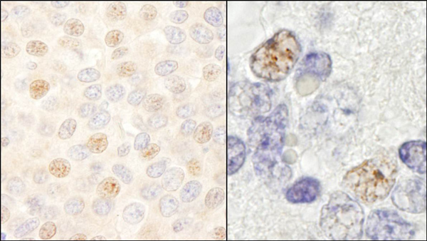 Immunohistochemistry (Formalin/PFA-fixed paraffin-embedded sections) - Anti-DDX46 antibody (AB72083)