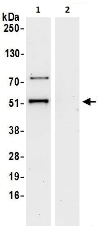Immunoprecipitation - Anti-DDX47 antibody (AB225870)