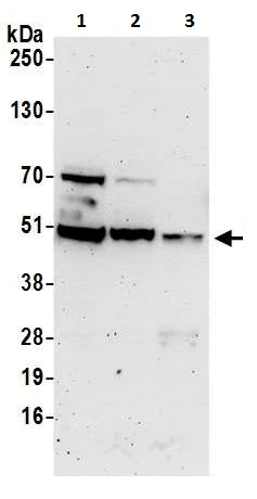 Western blot - Anti-DDX47 antibody (AB225870)