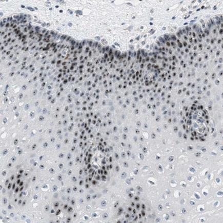 Immunohistochemistry (Formalin/PFA-fixed paraffin-embedded sections) - Anti-DDX47 antibody - C-terminal (AB224094)