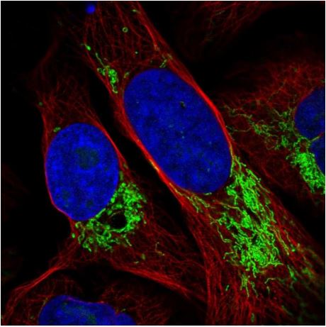 Immunocytochemistry - Anti-DDX49 antibody (AB188010)