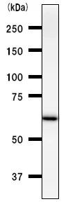 Western blot - Anti-DDX5 antibody [2257C3a] (AB53216)