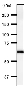 Western blot - Anti-DDX5 antibody [2257C3a] (AB53216)