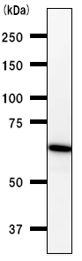 Western blot - Anti-DDX5 antibody [2257C3a] (AB53216)