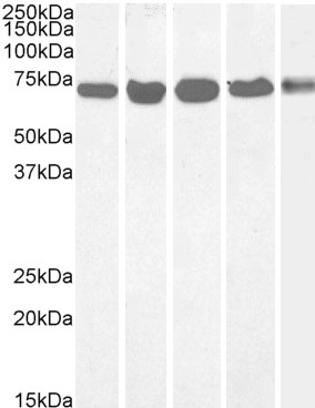 Western blot - Anti-DDX5 antibody (AB10261)