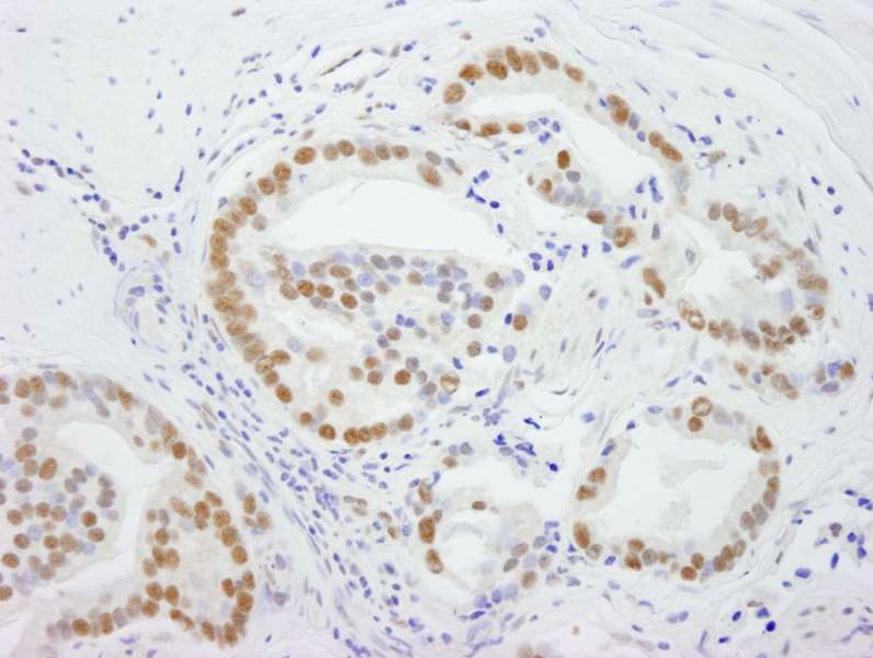 Immunohistochemistry (Formalin/PFA-fixed paraffin-embedded sections) - Anti-DDX5 antibody (AB264424)