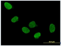 Immunocytochemistry/ Immunofluorescence - Anti-DDX5 antibody (AB92917)