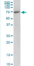 Western blot - Anti-DDX5 antibody (AB92917)