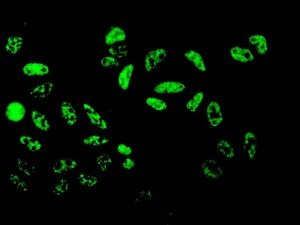 Immunocytochemistry/ Immunofluorescence - Anti-DDX5 antibody [EPR7239] (AB126730)