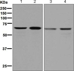 Western blot - Anti-DDX5 antibody [EPR7239] (AB126730)