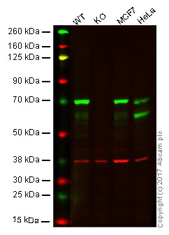 Western blot - Anti-DDX5 antibody [EPR7239] (AB126730)