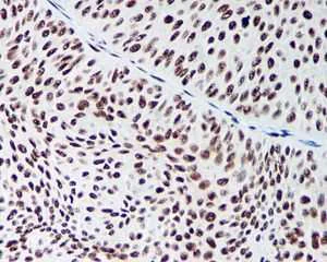 Immunohistochemistry (Formalin/PFA-fixed paraffin-embedded sections) - Anti-DDX5 antibody [EPR7239] - BSA and Azide free (AB240028)
