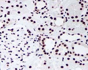 Immunohistochemistry (Formalin/PFA-fixed paraffin-embedded sections) - Anti-DDX5 antibody [EPR7239] - BSA and Azide free (AB240028)