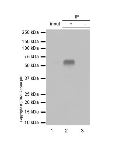 Immunoprecipitation - Anti-DDX5 antibody [EPR7239] - BSA and Azide free (AB240028)