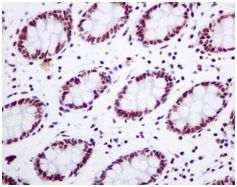 Immunohistochemistry (Formalin/PFA-fixed paraffin-embedded sections) - Anti-DDX5 antibody [EPR7240] (AB128928)