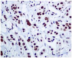 Immunohistochemistry (Formalin/PFA-fixed paraffin-embedded sections) - Anti-DDX5 antibody [EPR7240] (AB128928)