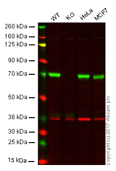 Western blot - Anti-DDX5 antibody [EPR7240] (AB128928)