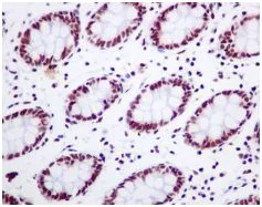 Immunohistochemistry (Formalin/PFA-fixed paraffin-embedded sections) - Anti-DDX5 antibody [EPR7240] - BSA and Azide free (AB248227)