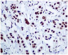 Immunohistochemistry (Formalin/PFA-fixed paraffin-embedded sections) - Anti-DDX5 antibody [EPR7240] - BSA and Azide free (AB248227)