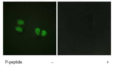 Immunocytochemistry/ Immunofluorescence - Anti-DDX5 (phospho Y593) antibody (AB62255)