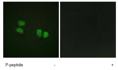Immunocytochemistry/ Immunofluorescence - Anti-DDX5 (phospho Y593) antibody (AB62255)