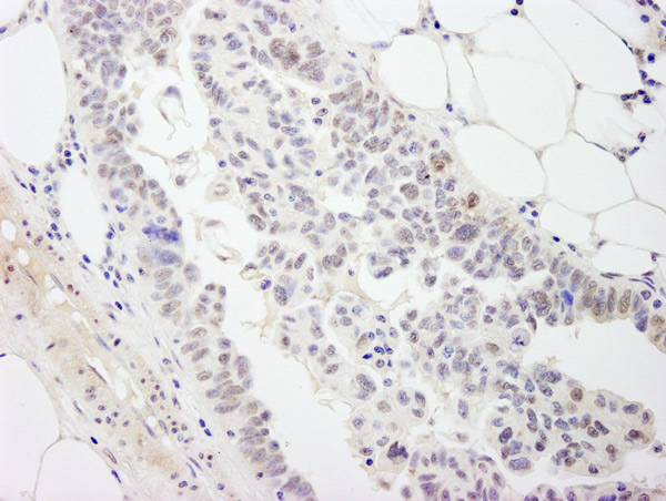 Immunohistochemistry (Formalin/PFA-fixed paraffin-embedded sections) - Anti-DDX54 antibody (AB76947)