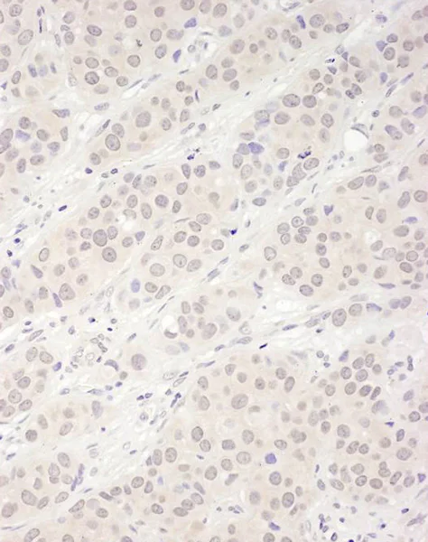 Immunohistochemistry (Formalin/PFA-fixed paraffin-embedded sections) - Anti-DDX56/DDX21 antibody (AB115178)