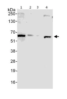 Western blot - Anti-DDX56/DDX21 antibody (AB115178)