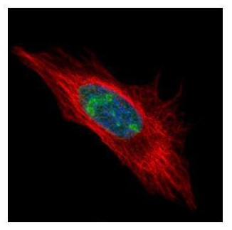 Immunocytochemistry/ Immunofluorescence - Anti-DDX56/DDX21 antibody (AB97648), expandable thumbnail