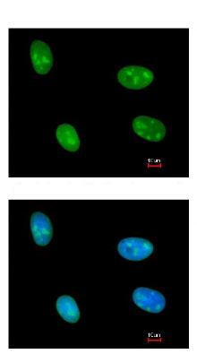 Immunocytochemistry/ Immunofluorescence - Anti-DDX56/DDX21 antibody (AB97648), expandable thumbnail