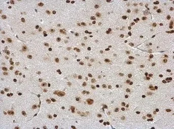 Immunohistochemistry (Formalin/PFA-fixed paraffin-embedded sections) - Anti-DDX56/DDX21 antibody (AB97648)