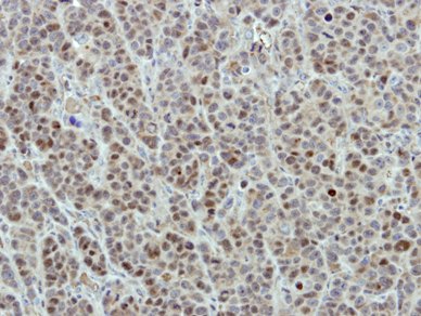 Immunohistochemistry (Formalin/PFA-fixed paraffin-embedded sections) - Anti-DDX56/DDX21 antibody (AB97648), expandable thumbnail