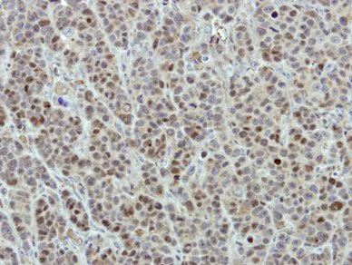 Immunohistochemistry (Formalin/PFA-fixed paraffin-embedded sections) - Anti-DDX56/DDX21 antibody (AB97648)