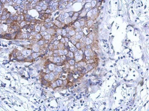 Immunohistochemistry (Formalin/PFA-fixed paraffin-embedded sections) - Anti-DDX59 antibody (AB229206), expandable thumbnail