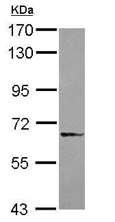 Western blot - Anti-DDX59 antibody (AB229206), expandable thumbnail