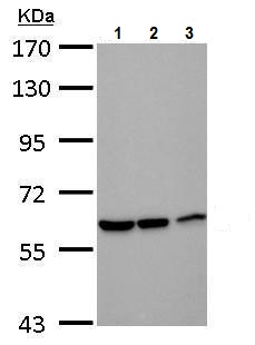 Western blot - Anti-DDX59 antibody (AB229206), expandable thumbnail