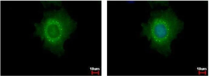 Immunocytochemistry/ Immunofluorescence - Anti-DDX6 antibody (AB151984)