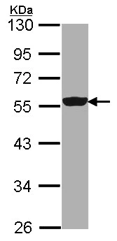 Western blot - Anti-DDX6 antibody (AB151984)